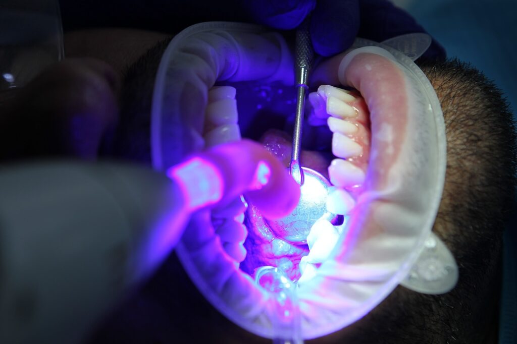 How to Prevent Sensitivity During Teeth Whitening with Light