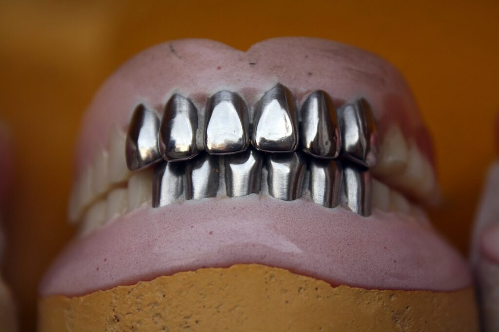 The Pros and Cons of Amalgam Fillings