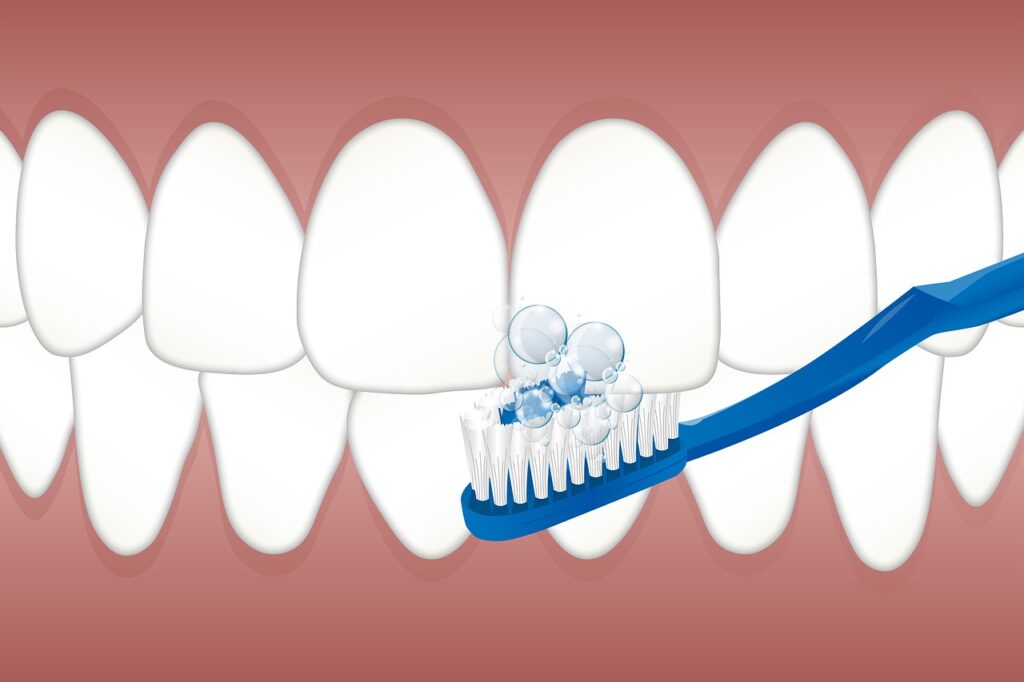 What to expect during a dental deep cleaning