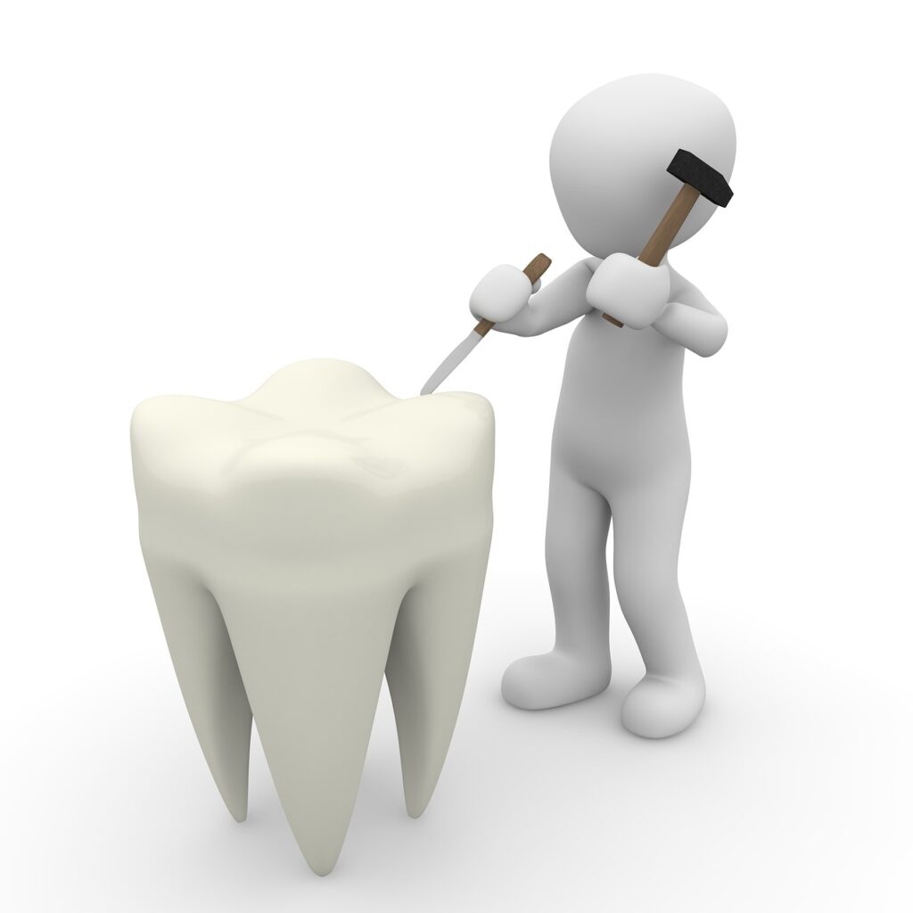 The impact of dental anxiety on cavity risk and prevention