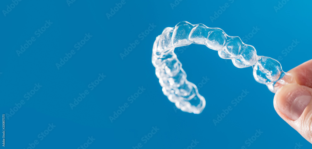 Dental Braces