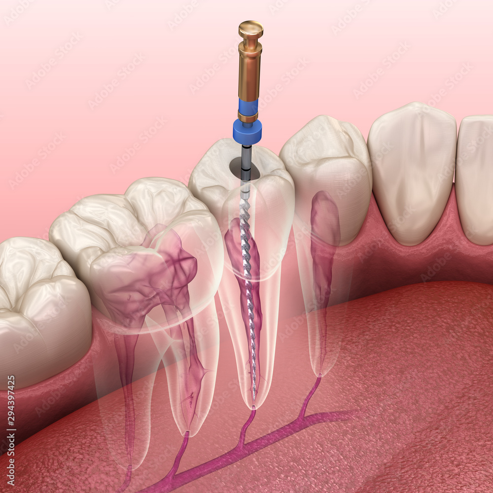 Pregnancy and Sedation Dentistry What You Need to Know