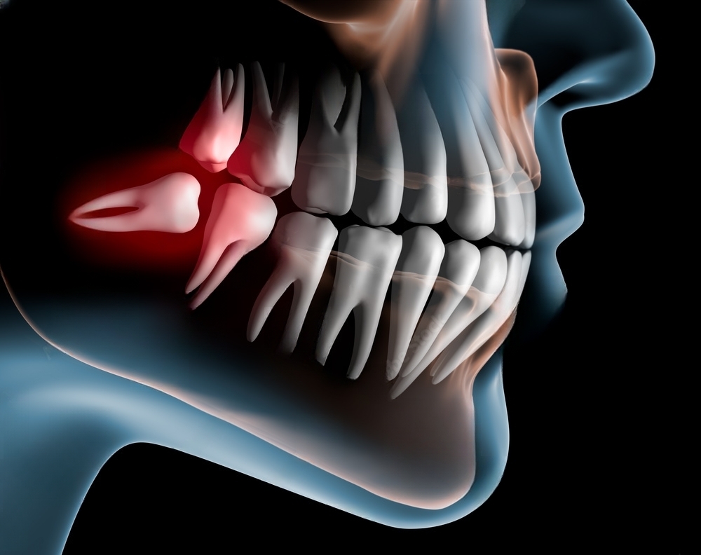 Medications and their impact on jawbone health