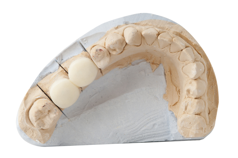 Understanding and treating bruxism teeth grinding