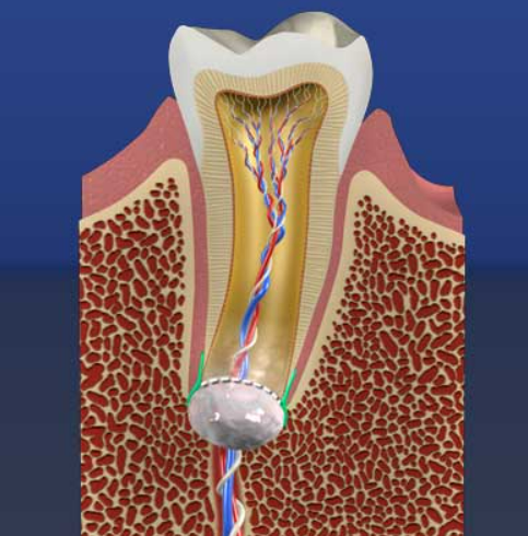 The Effects of Grape Seed Extract Supplements on Your Dental Health