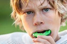 Mouthguard