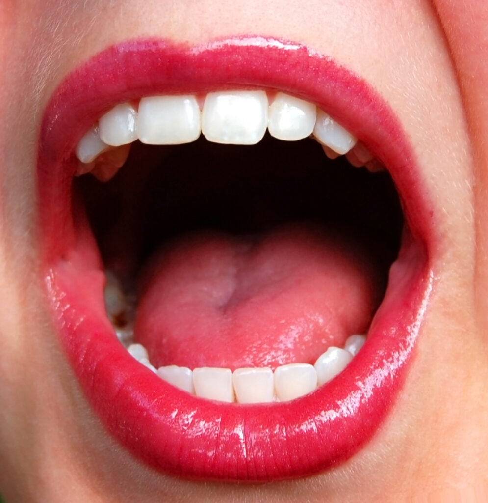 The Connection Between Pregnancy and Dry Mouth Causes and Remedies