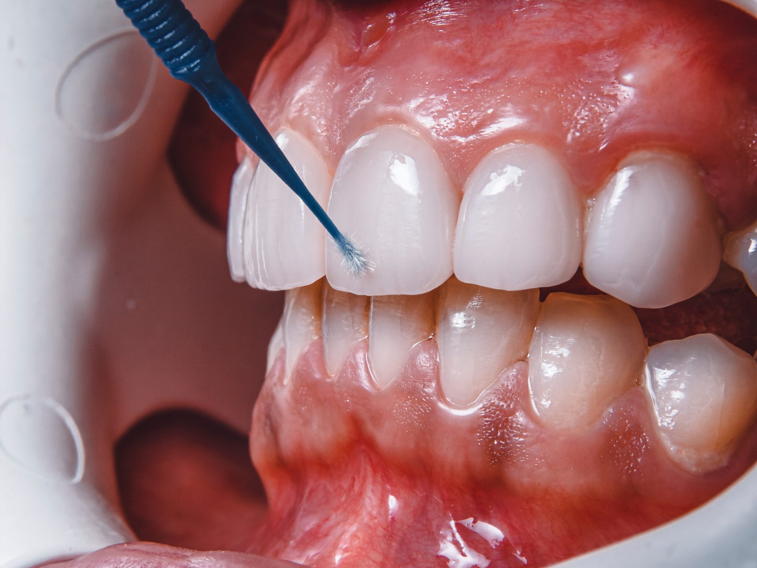 The Connection Between Gum Disease and Heart Health