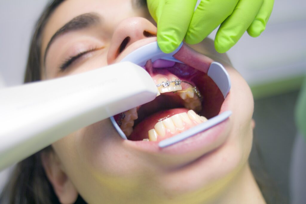 How to Prevent Sensitivity After Oral Surgery