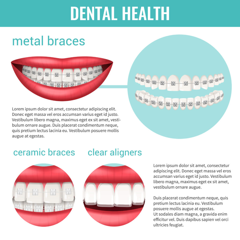 The Connection Between Braces and Heart Disease: What You Need to Know
