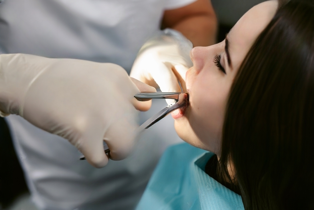 How to Treat Cavities in Teeth with Thin Enamel