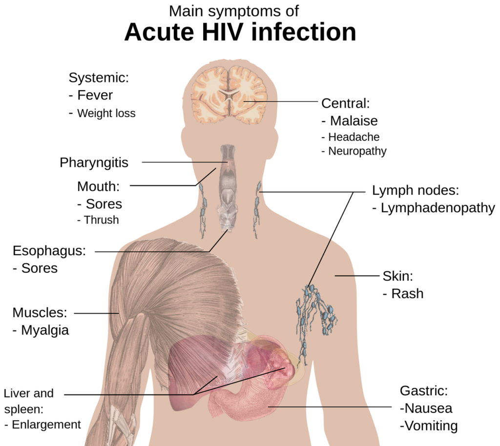 The effect of medication for HIVAIDS on oral health