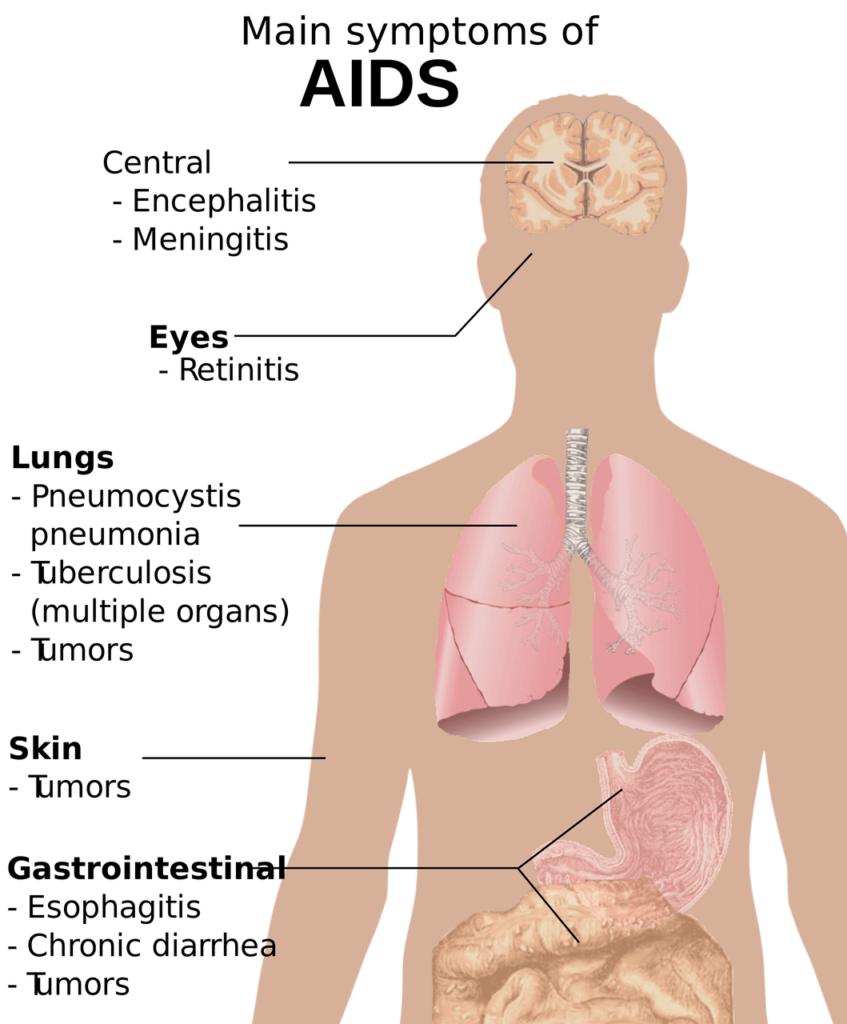 The effect of medication for HIVAIDS on oral health