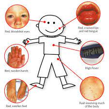 The Relationship Between Celiac Disease and Heart Disease Implications for Dental Health